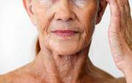 Người cao tuổi và bệnh ngoài da mùa hanh khô